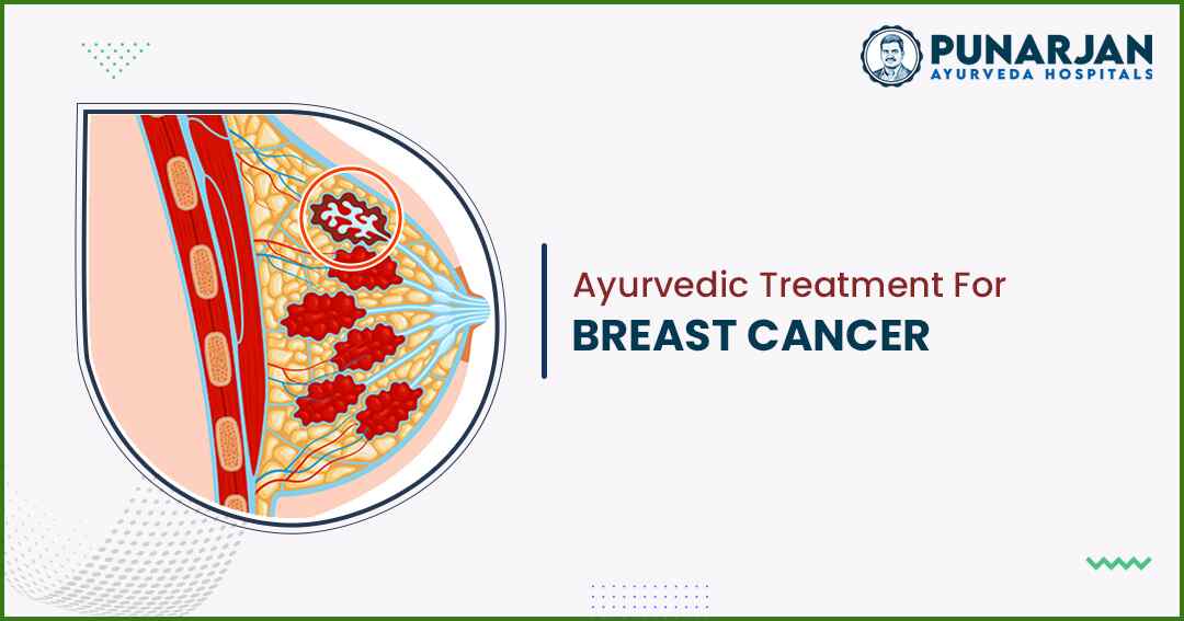 You are currently viewing Ayurvedic Treatment For Breast Cancer