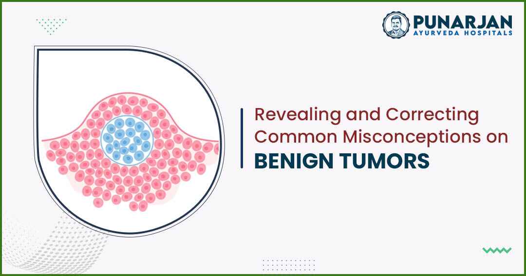 Revealing and Correcting Common Misconceptions on Benign Tumors -Punarjan Ayurveda