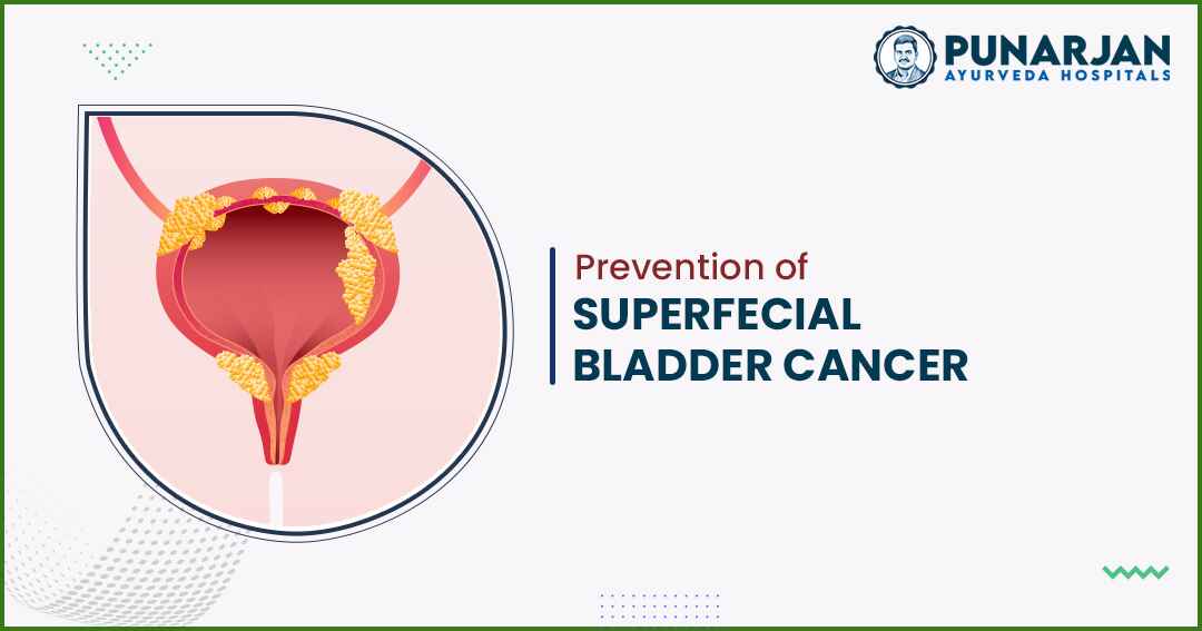 You are currently viewing Prevention Of Superficial Bladder Cancer