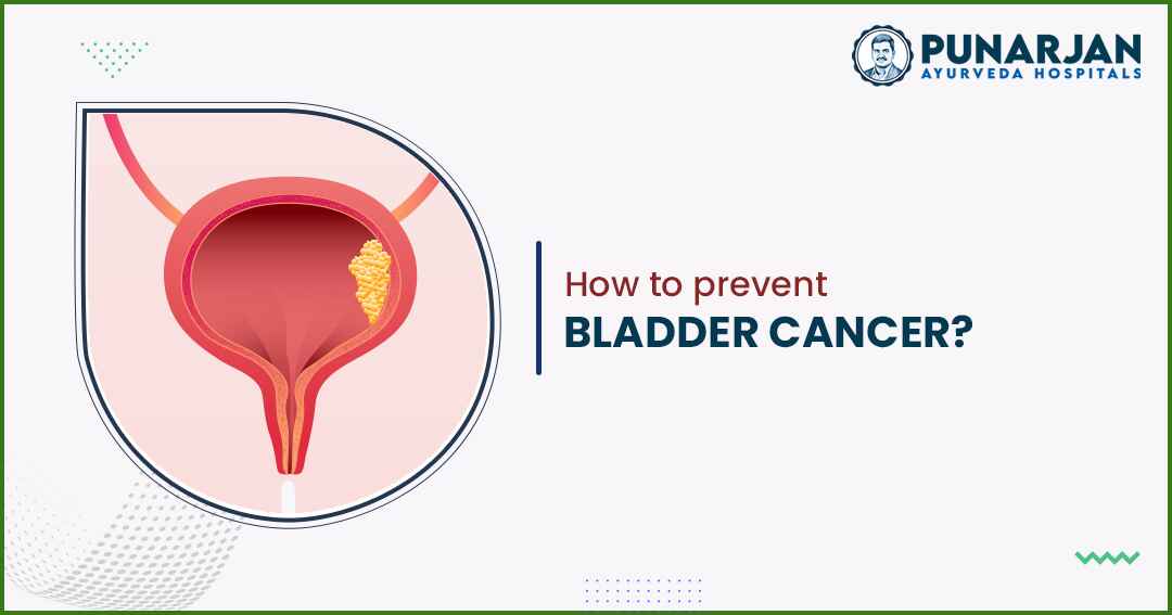 Best bladder cancer treatment hospitals in Bangalore