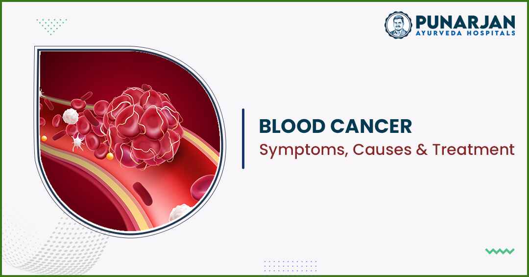 You are currently viewing Blood Cancer (Leukaemia): Symptoms, Causes And Treatment