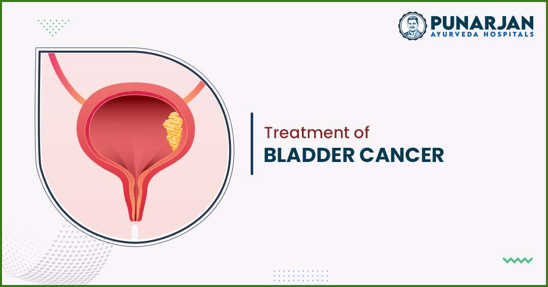 best bladder cancer treatment hospital in Bangalore