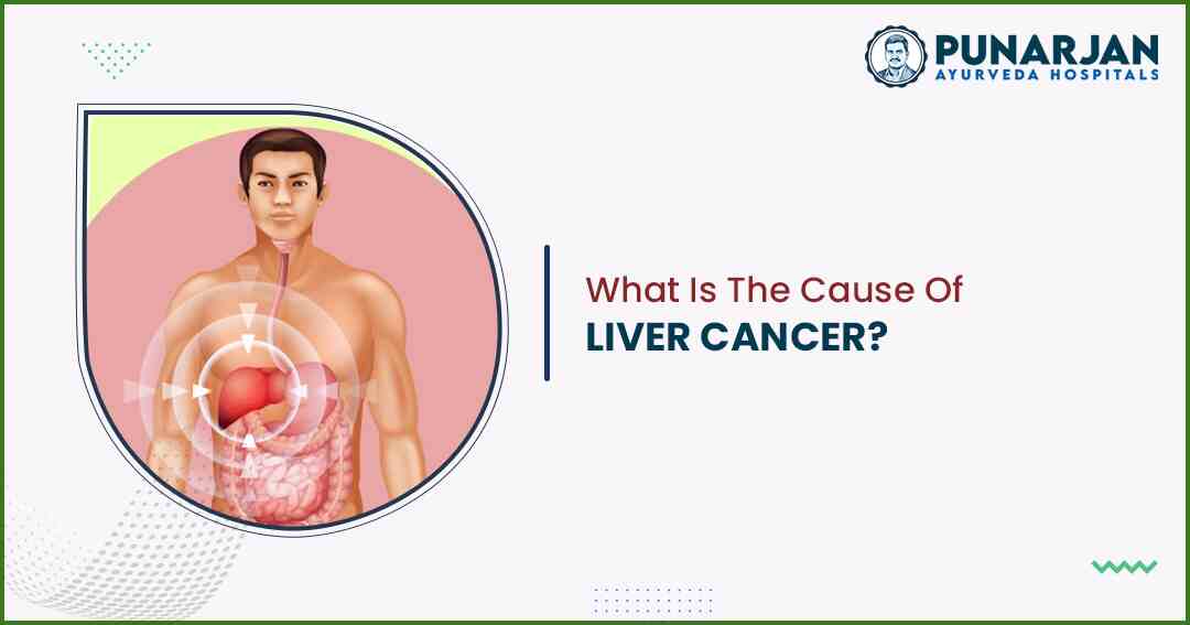 You are currently viewing What Is The Cause Of Liver Cancer?