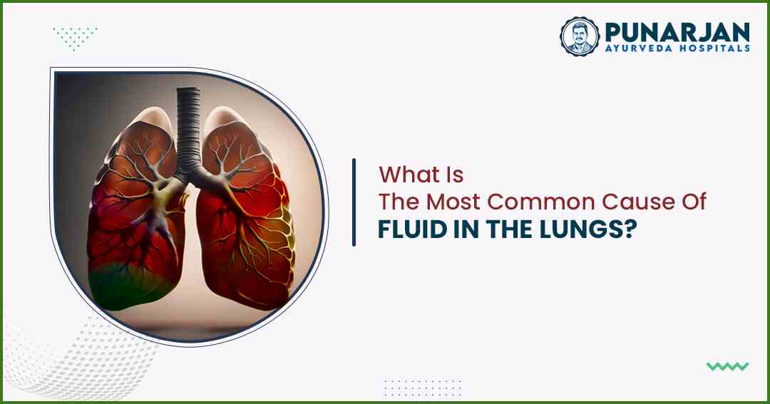 What Is The Most Common Cause Of Fluid In The Lungs - Punarjan Ayurveda