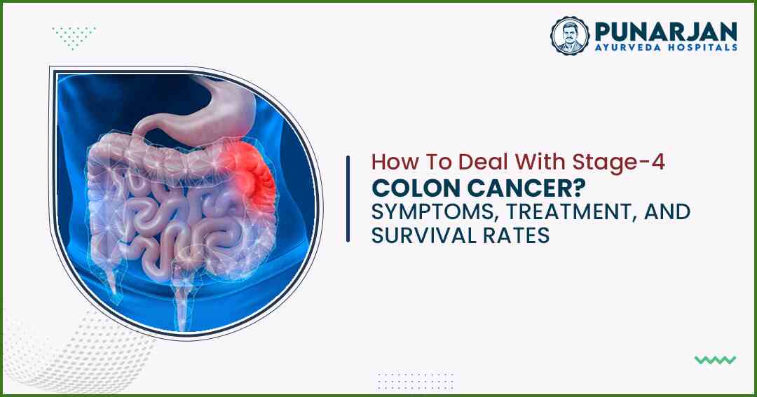 l With Stage 4 Colon Cancer Symptoms, Treatment, And Survival Rates - Punarjan Ayurveda