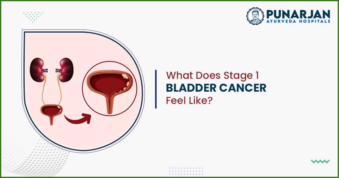 You are currently viewing What Does Stage 1 Bladder Cancer Feel Like?