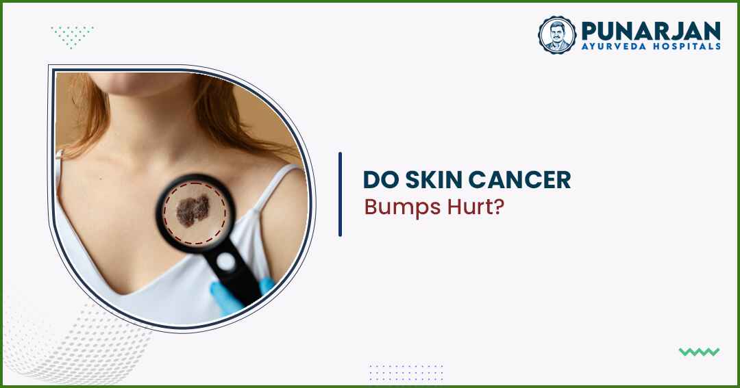 Do Skin Cancer Bumps Hurt?