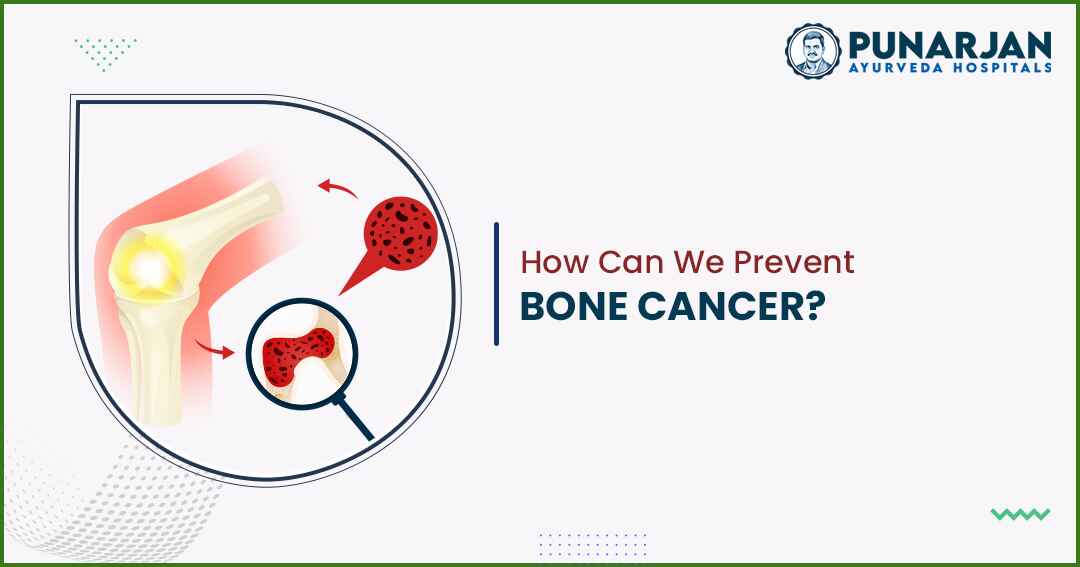 You are currently viewing How Can We Prevent Bone Cancer?