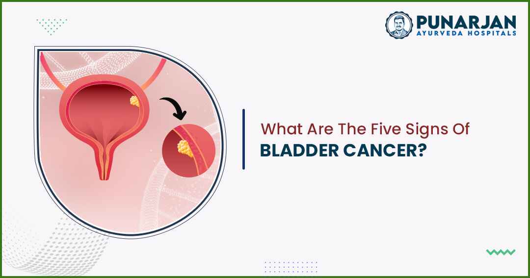 You are currently viewing What Are The Five Signs Of Bladder Cancer?