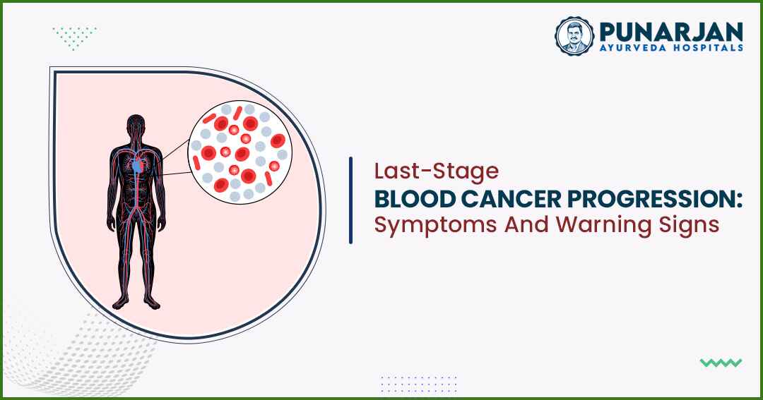 You are currently viewing Last-Stage Blood Cancer Progression: Symptoms And Warning Signs