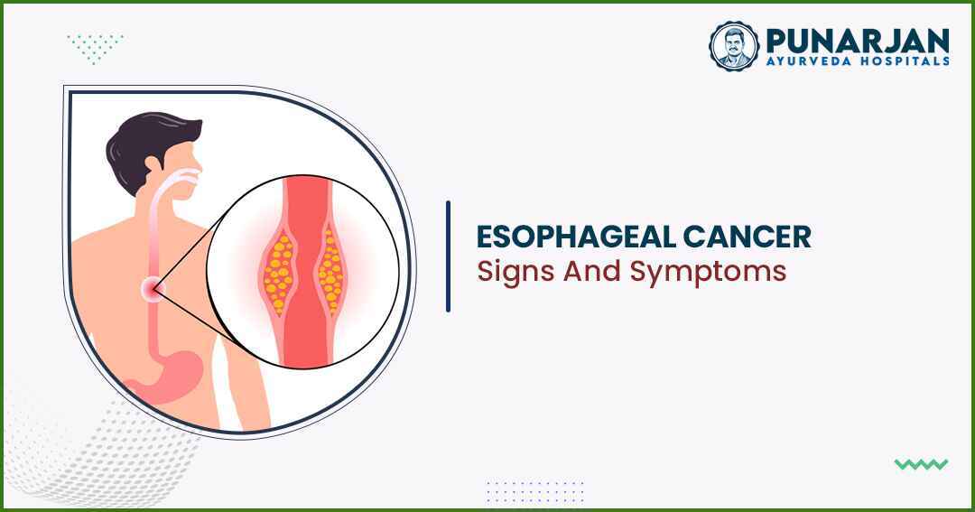 Esophageal Cancer Signs And Symptoms