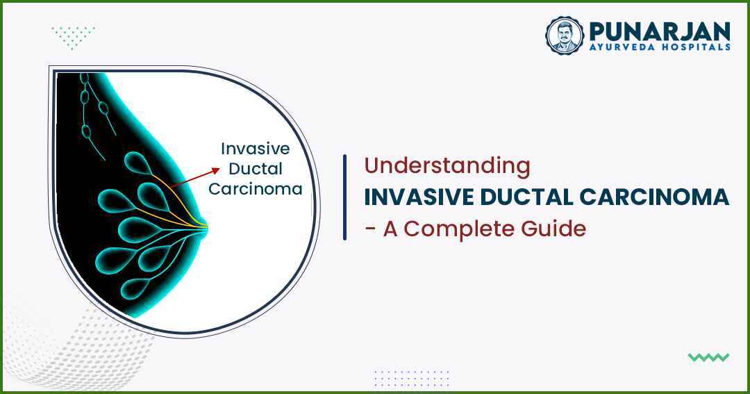 Understanding invasive ductal carcinoma
