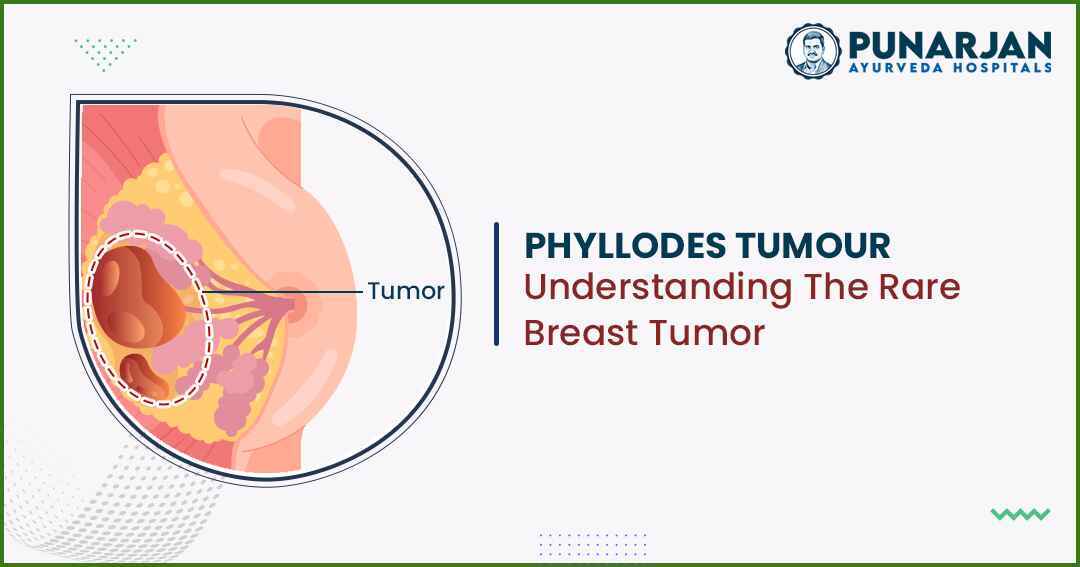 Phylloders tumour understanding the rare breast tumor