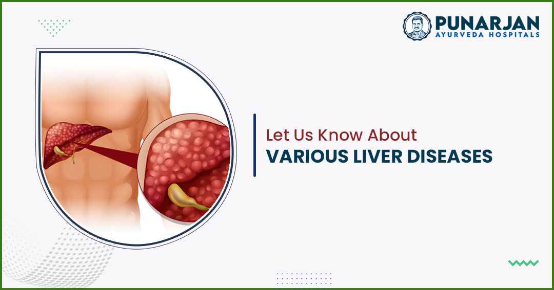 Let Us Know About Various Liver Diseases