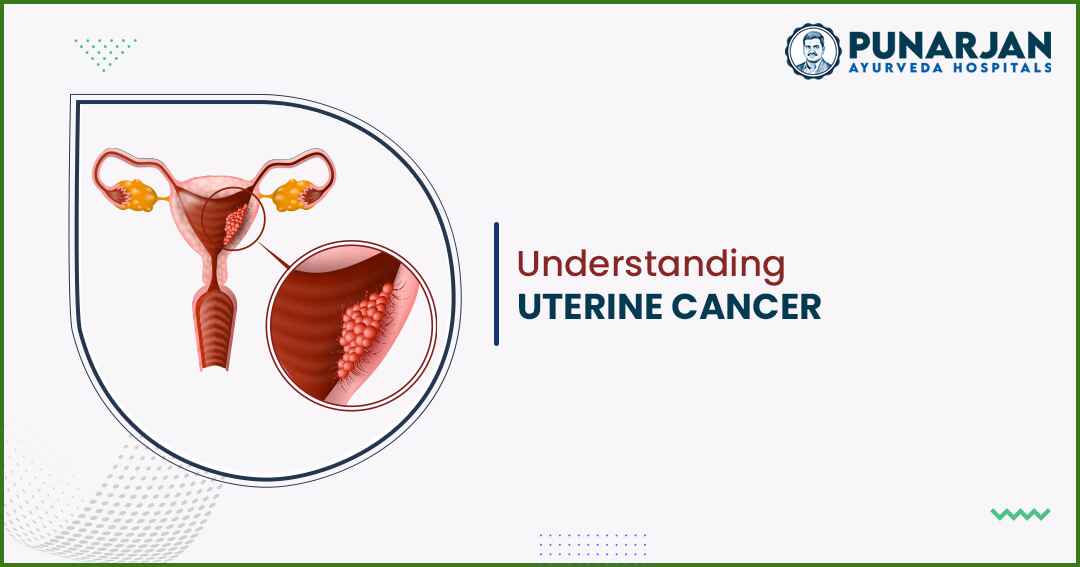 Understanding Uterine Cancer