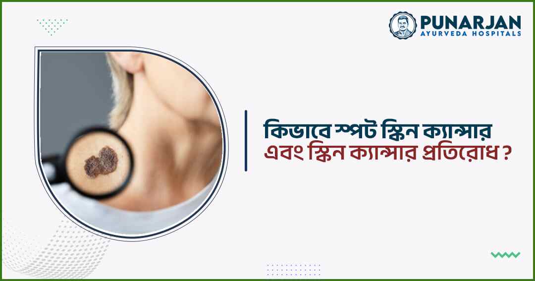 How to Spot Skin Cancer and Prevention of Skin Cancer - Punarjan Ayurveda