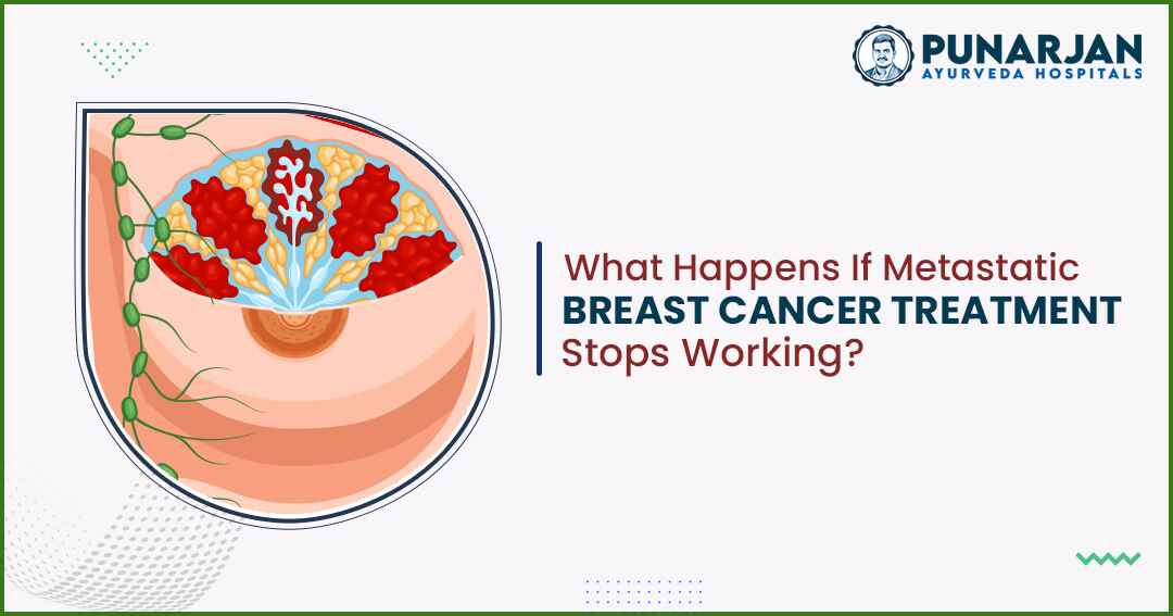 If Metastatic Breast Cancer Treatment Stops Working Then What Happens