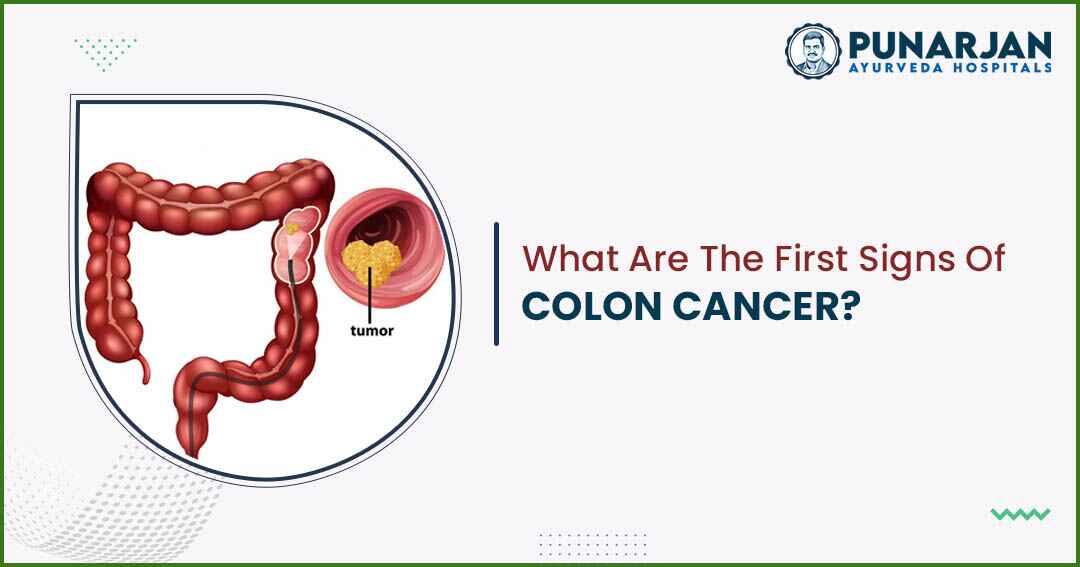 First Signs Of Colon Cancer?