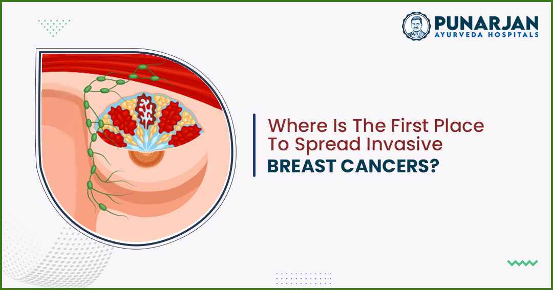 Where Is The First Place To Spread Invasive Breast Cancers?