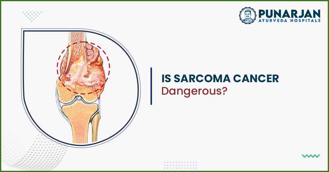 You are currently viewing Is Sarcoma Cancer Dangerous…?