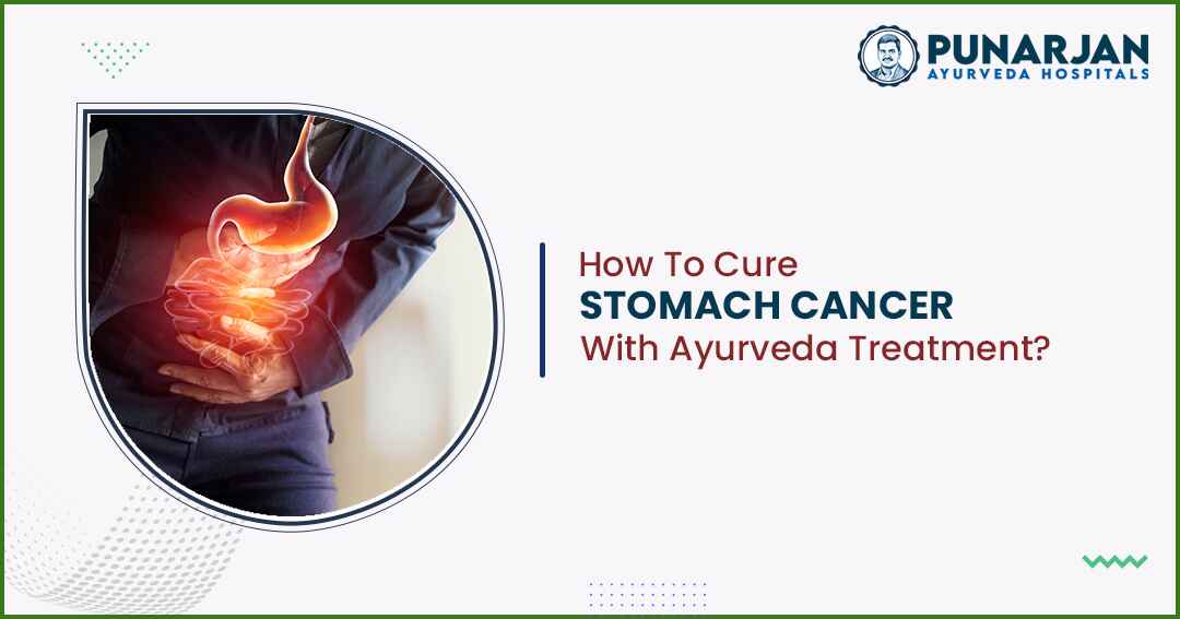 You are currently viewing How To Cure Stomach Cancer With Ayurveda Treatment?