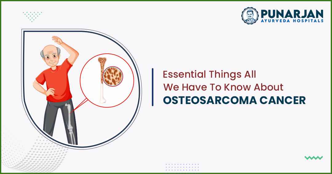 Essential Things All We Have To Know About Osteosarcoma Cancer