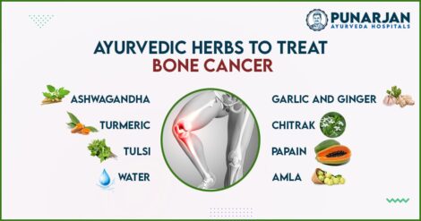 Ayurvedic-Herbs-to-Treat-Bone-Cancer-