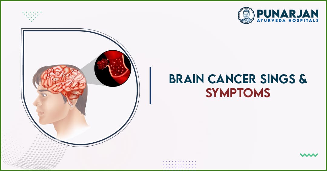 You are currently viewing Brain Cancer Signs And Symptoms