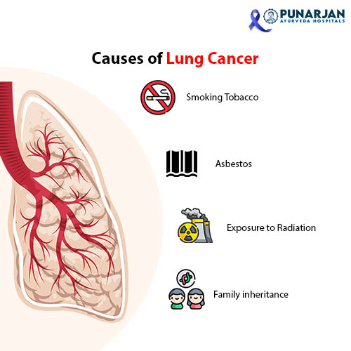 Causes Of Lung Cancer