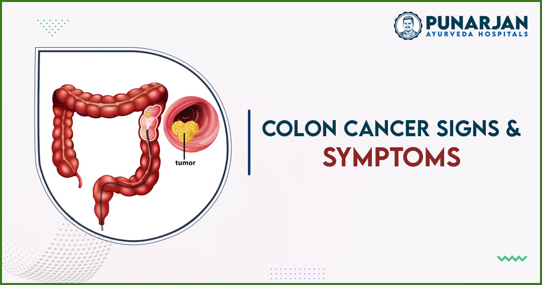 Signs And Symptoms Of Colon Cancer