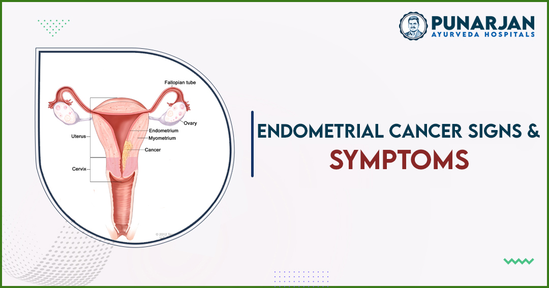 Signs And Symptoms Of Endometrial Cancer