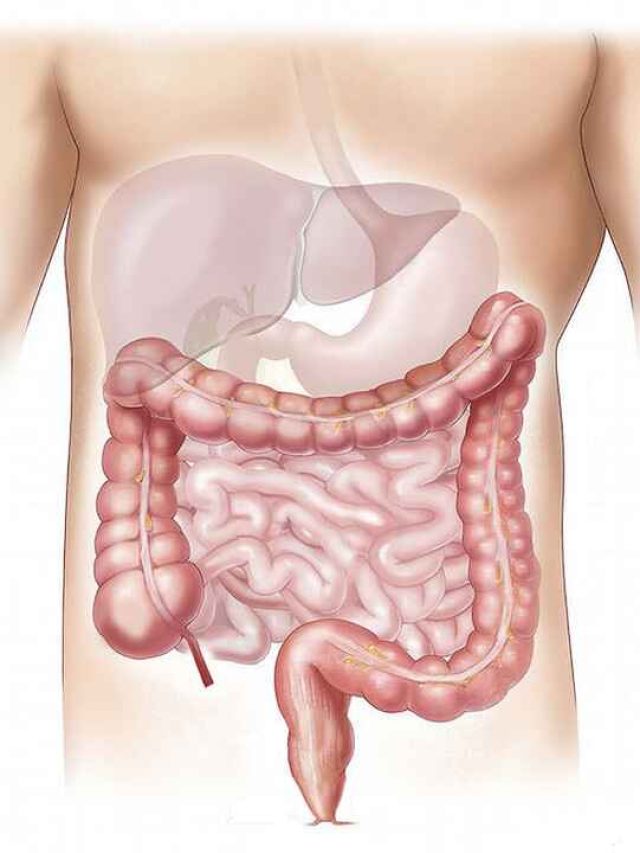 What is Leaky Gut ?
