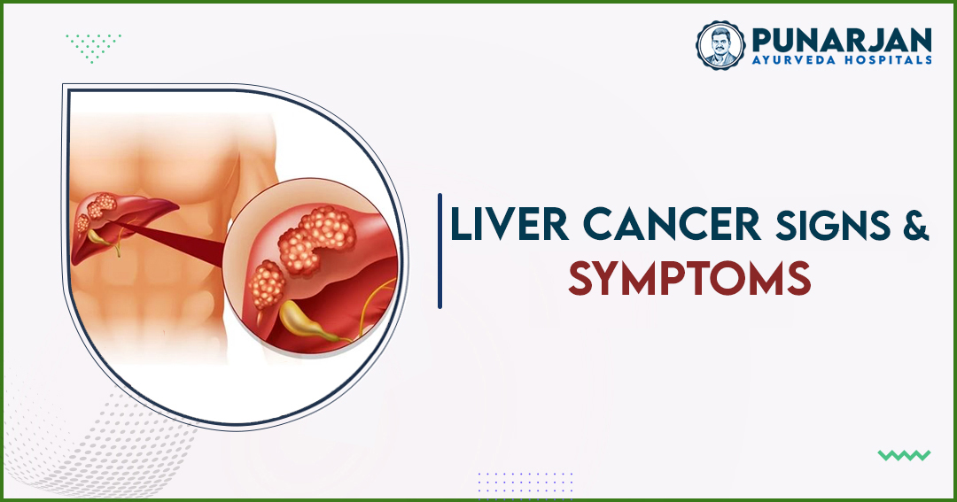 You are currently viewing Liver Cancer Signs And Symptoms