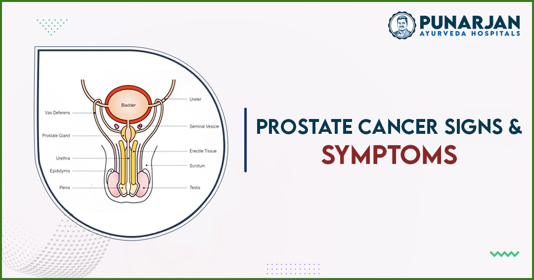 Signs And Symptoms Of Prostate Cancer