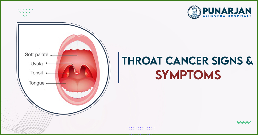 You are currently viewing Signs And Symptoms Of Throat Cancer