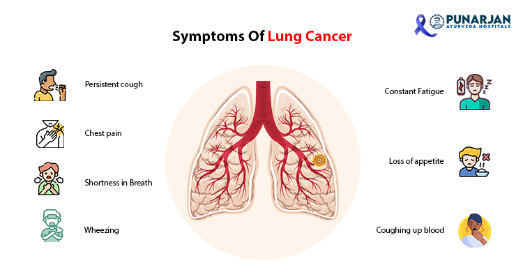 04_-Symptoms-Of-Lung-Cancer-copy