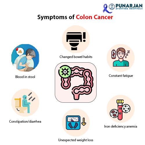06_Symptoms-of-Colon-Cancer
