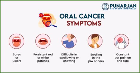 Oral-Cancer-Symptoms-470x247