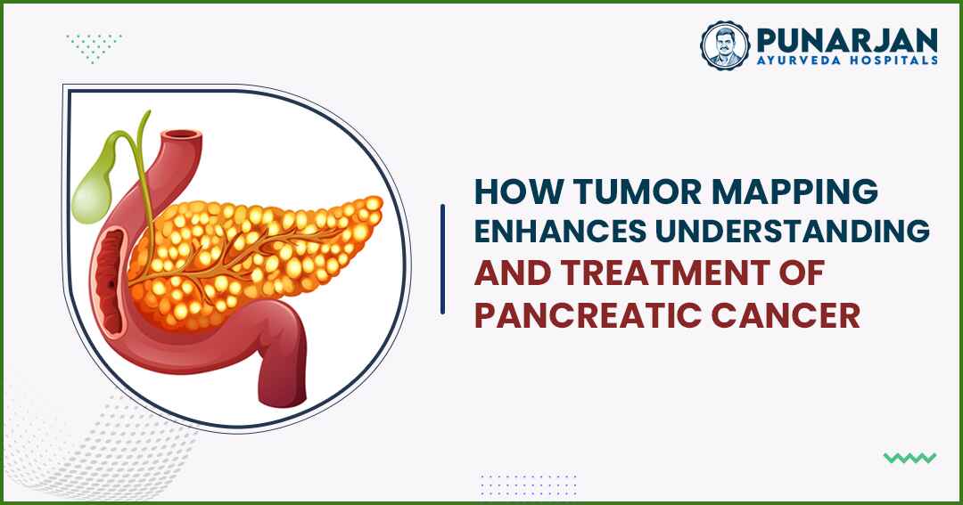 75_How Tumor Mapping Enhances Understanding and Treatment of Pancreatic Cancer -Punarjan Ayurveda