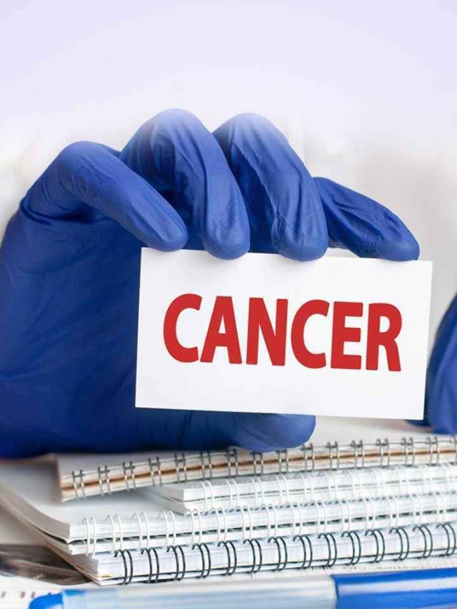 Study Links Lifestyle Choices to Cancer Risk