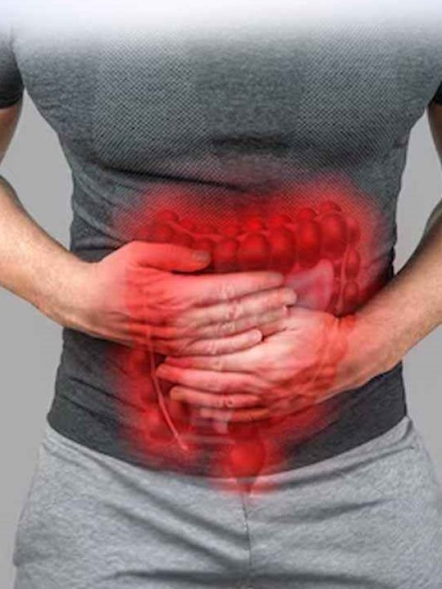 Colon Cancer in Youth: 6 Key Warning Signs