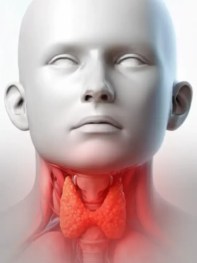 Thyroid Cancer Myths and Facts