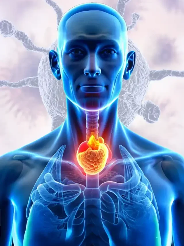 Esophageal Cancer Stages