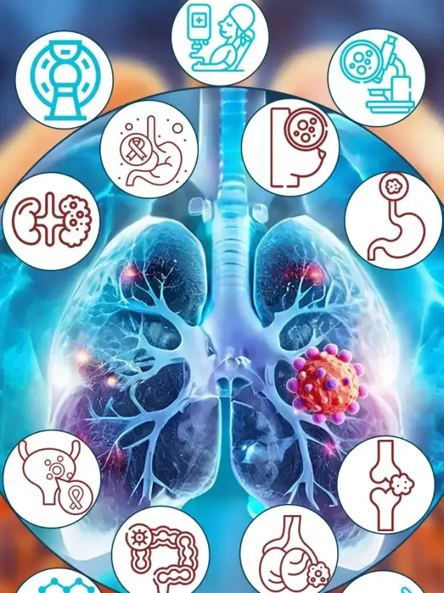 Secondary Lung Cancer and Its Treatment Pathway